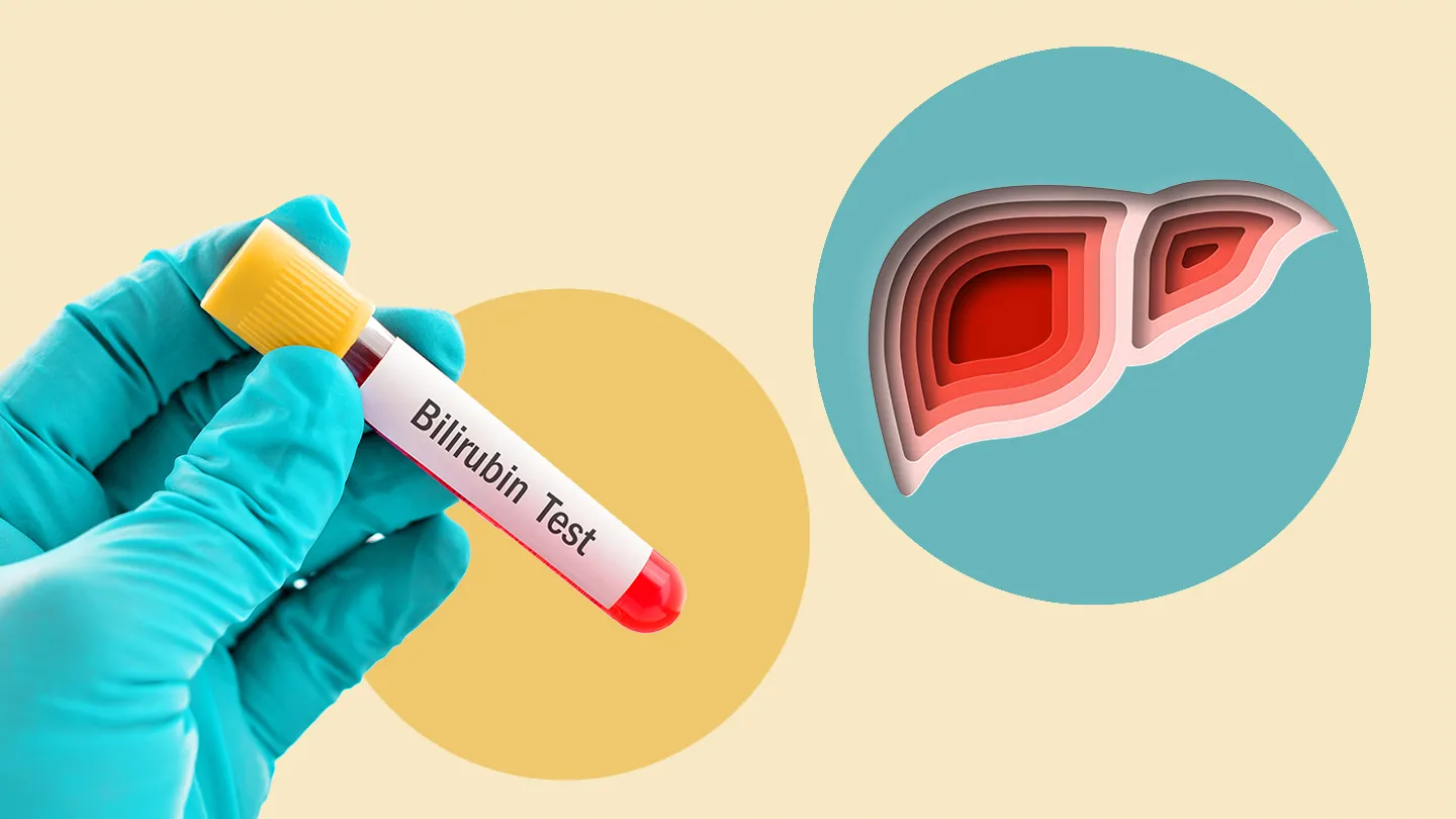 Serum Bilirubin